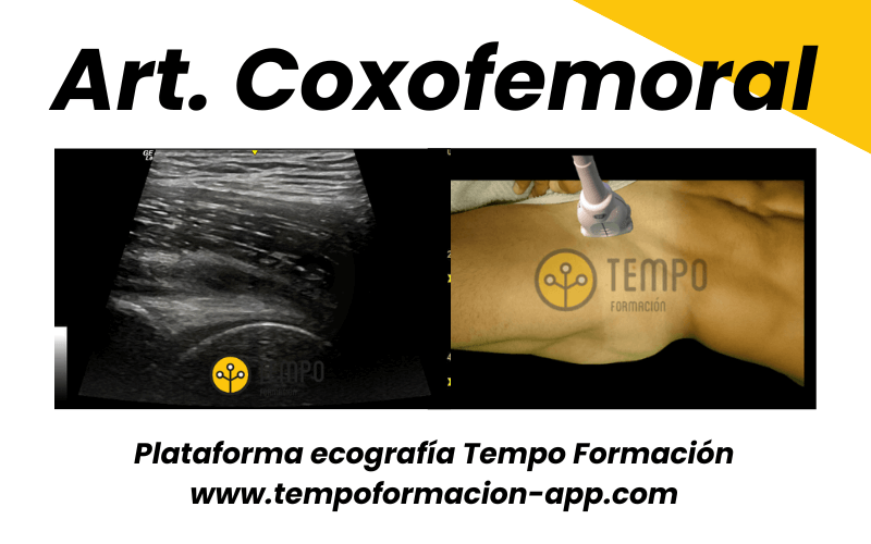1. Ecografia Tempo Formacion Articulacion Coxofemoral.png